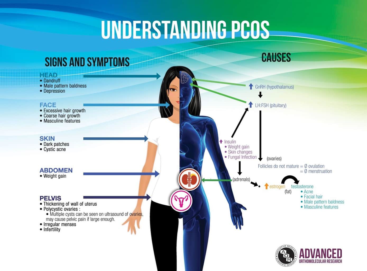 marijuana and pcos