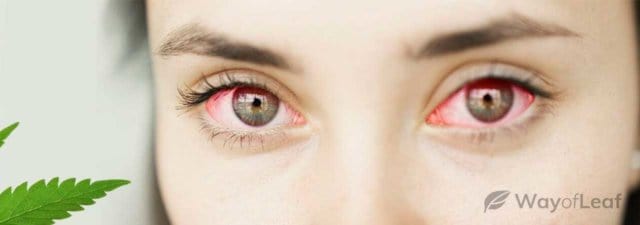 Does CBD Cause Red Eyes? Scientifically Explained